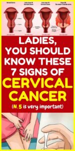 7 warning symptoms of cervical cancer that every women should know