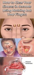 Natural Home Remedies to Clear Your Sinuses