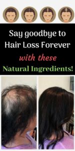 Say goodbye to Hair Loss forever with these Natural Ingredients!