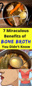 7 Miraculous Benefits Of Bone Broth You Didn’t Know