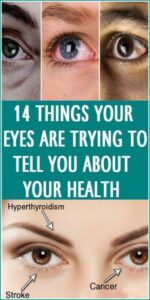 14 THINGS YOUR EYES ARE TRYING TO TELL YOU ABOUT YOUR HEALTH