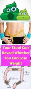 Your Stool Can Reveal Whether You Can Lose Weight
